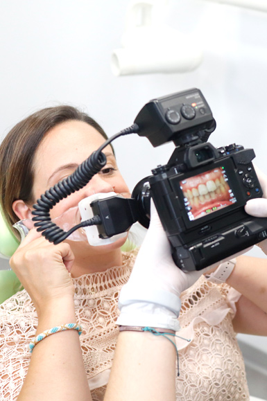 estudio de sonrisa digital para tratamiento de carillas dentales dentistas de estetica dental en oviedo