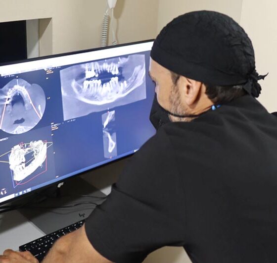 Ortodoncia multidisciplinar para la rehabilitación dental. Implantes dentales en Oviedo.