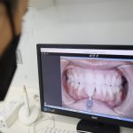 Dentista en Oviedo examinando la dentadura de un paciente tras una ortodoncia