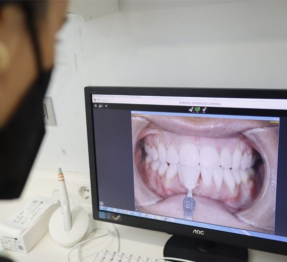 Dentista en Oviedo examinando la dentadura de un paciente tras una ortodoncia